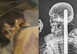 With new info revealed by X-ray, see Everhart Museum’s mummy before Scranton exhibit closes on April 7