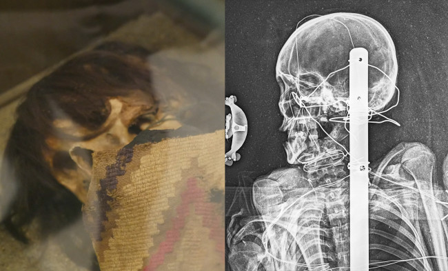 With new info revealed by X-ray, see Everhart Museum’s mummy before Scranton exhibit closes on April 7